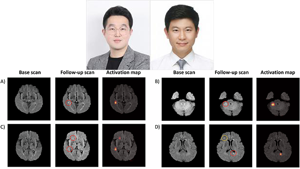INU Professor Hwan-ho Cho’s Research Team Collaborates with Hanyang University Guri Hospital to Develop AI Model for Automatic Detection of Silent Cerebral Infarction 대표이미지